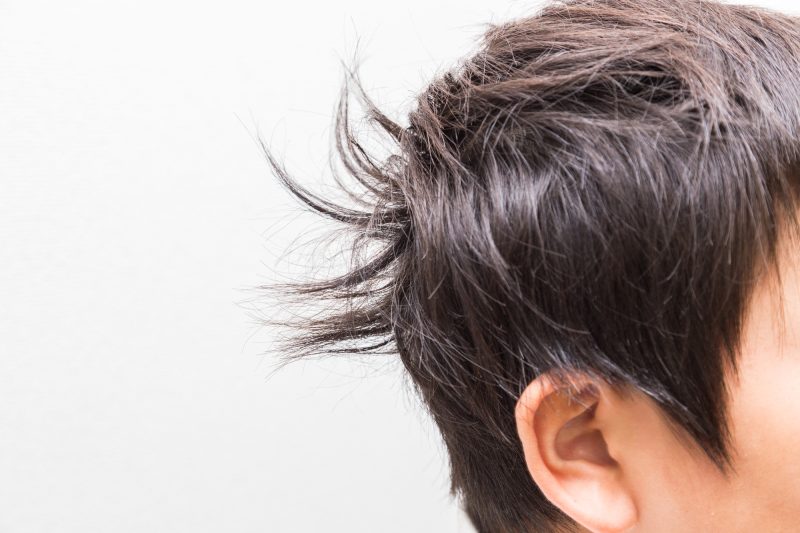 寝ぐせ/頭髪/髪型/男性